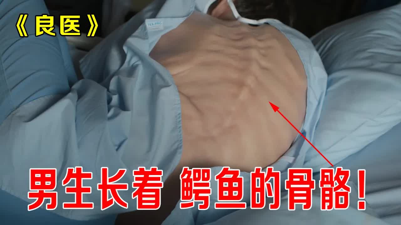男生长着鳄鱼骨骼，被学生称为&ldquo;鳄鱼男孩，罪魁祸首竟然是学校《良医》
