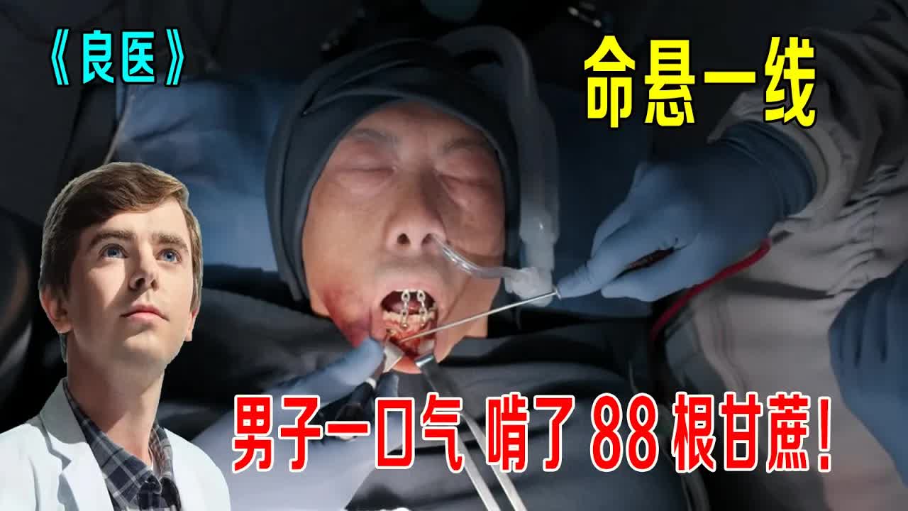 男子一口气啃了88根甘蔗，命悬一线，天才肖恩竟然用荧光灯做手术《良医》